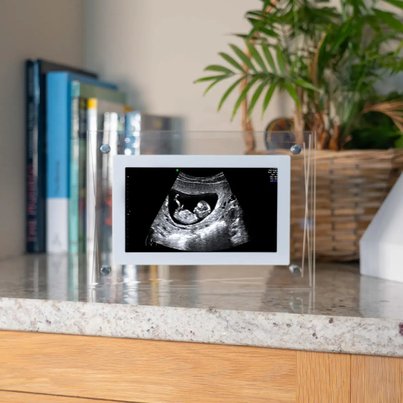 Digital Ultrasound Frame