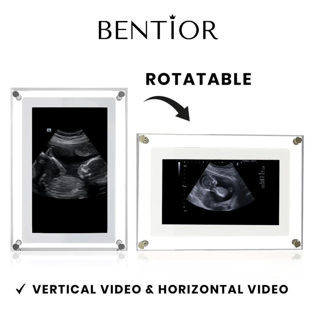 Digital Ultrasound Frame